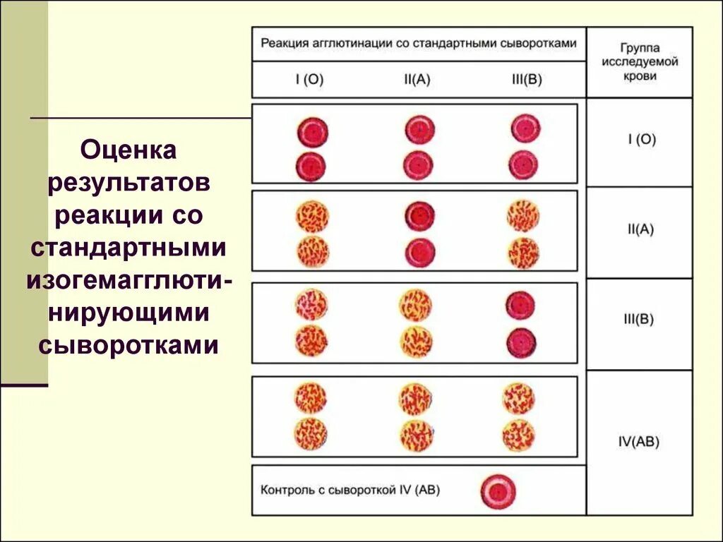 Реакция агглютинации происходит. Реакция агглютинации со стандартными сыворотками. схема реакции агглютинации группы крови. реакция агглютинации со стандартными сыворотками группа крови. реакция агглютинации со стандартными сыворотками таблица.