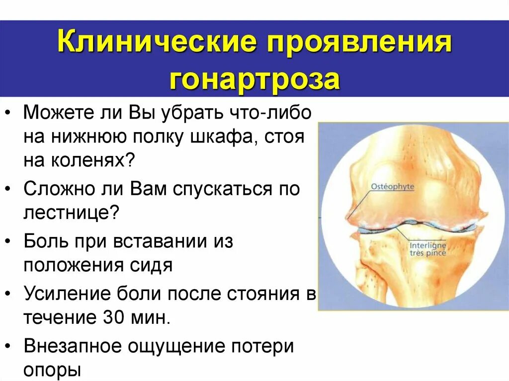 Гонартроз клинические рекомендации тест ответы. Упражнения от гонартроза. Степени гонартроза мрт. Двусторонний гонартроз формулировка диагноза. Диагностические критерии гонартроза.