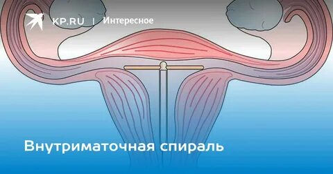 Если стоит спираль можно