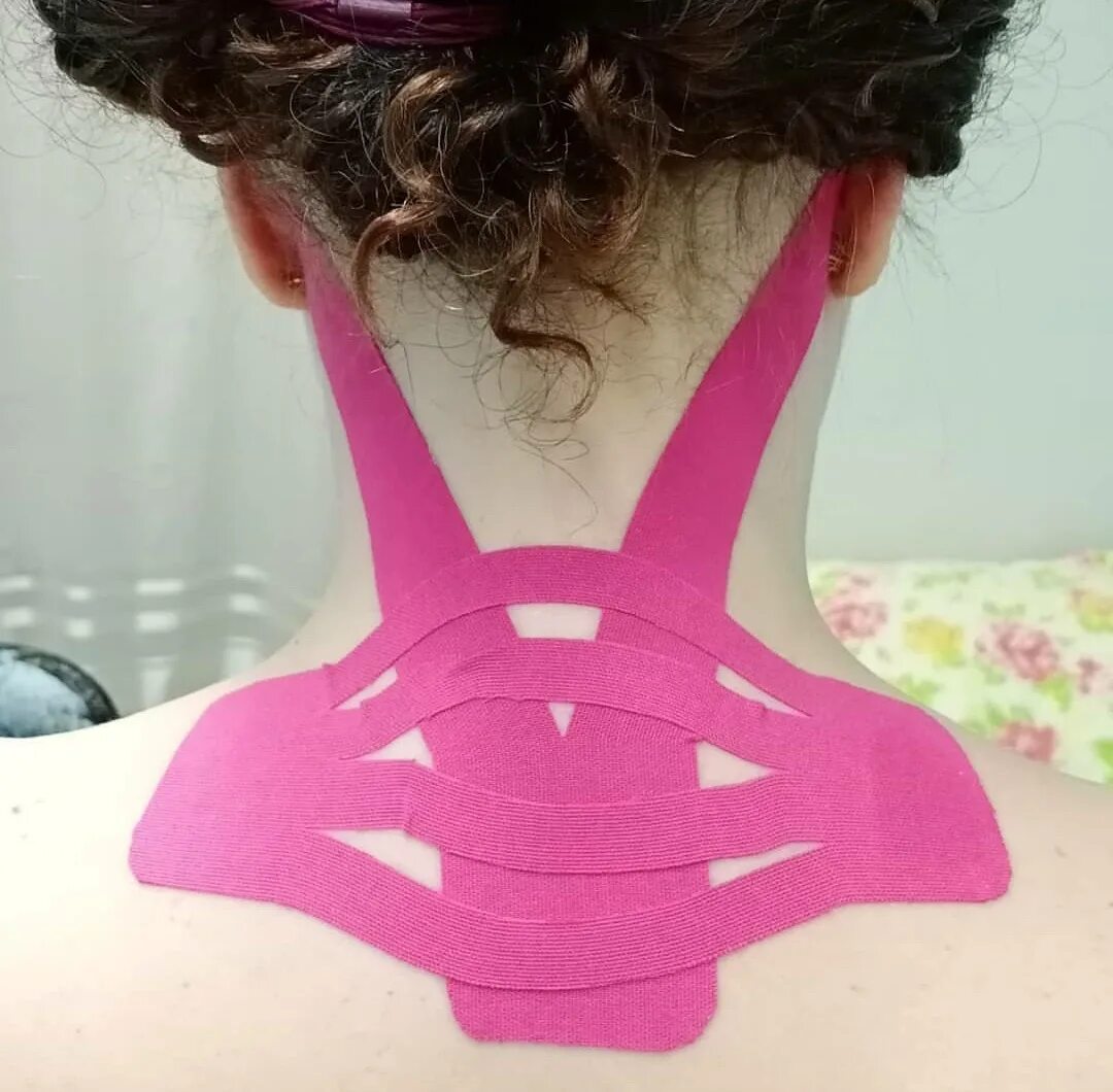 Тейпирование кпс. Кинезио тейп вдовий горб. Тейпирование вдовьего горба. Шейно воротниковая зона тейпирование. Тейпы на холку.