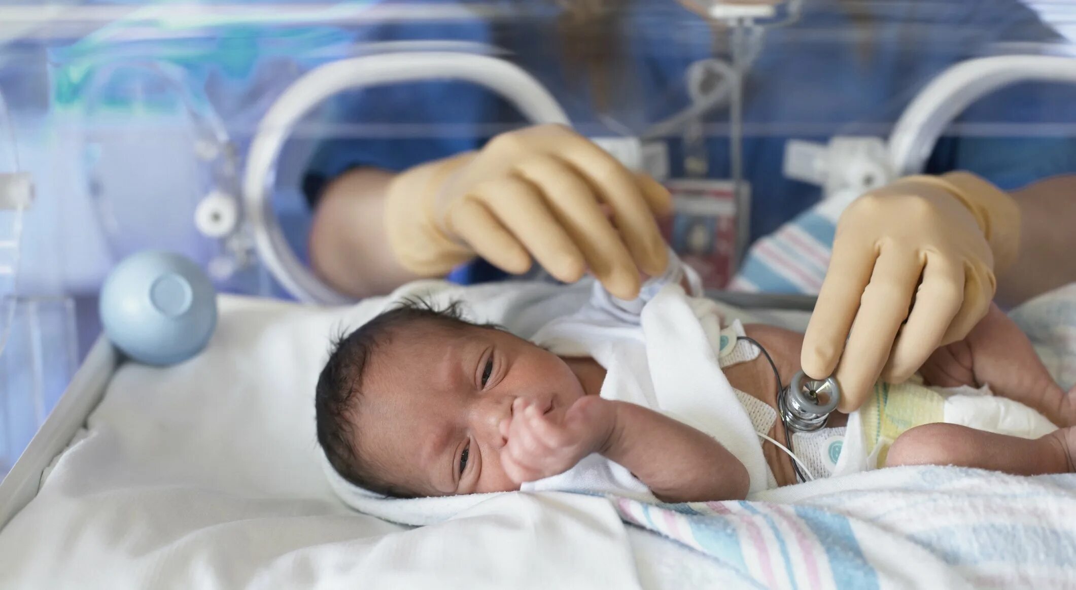 Недоношенные Новорожденные. Новорожденный ребенок недоношенные дети. День неонатолога