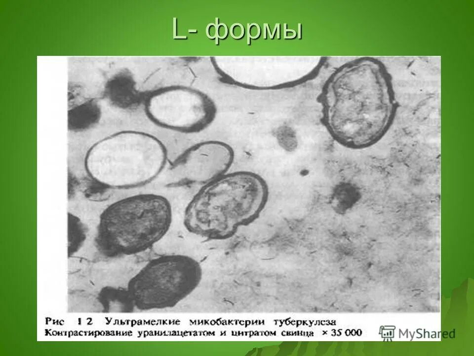 Микобактерии туберкулеза формы. L формы бактерий. Формы микобактерий туберкулеза.