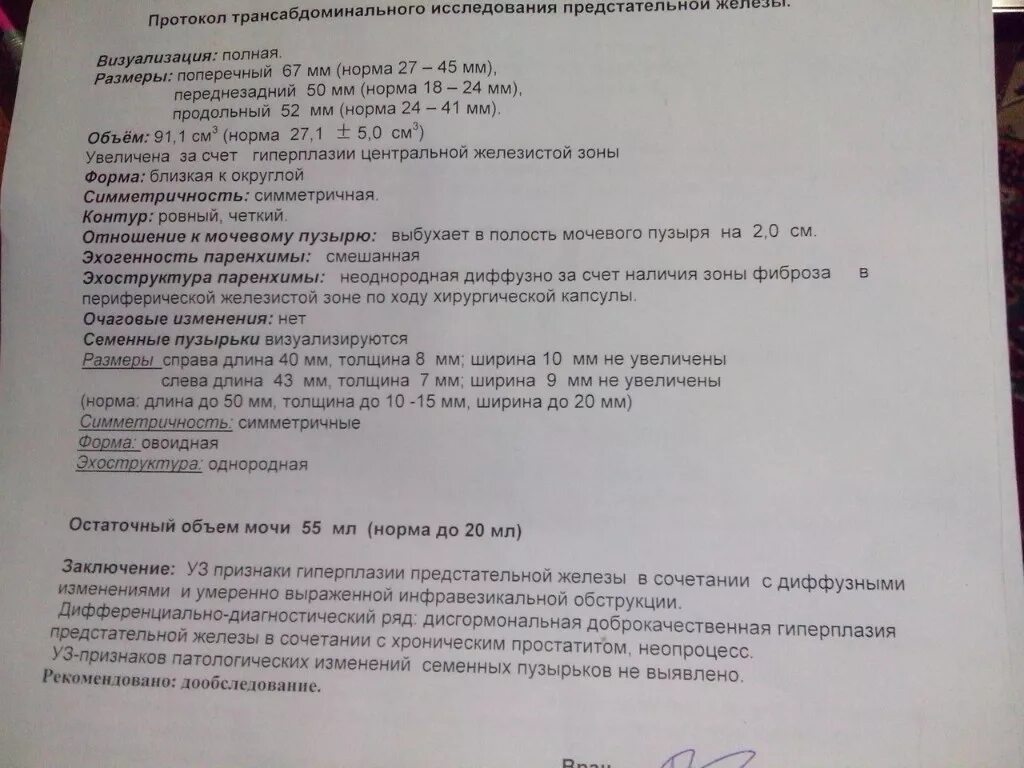 Тактика лечения рака предстательной железы - Вопрос онкологу - 03 Онлайн
