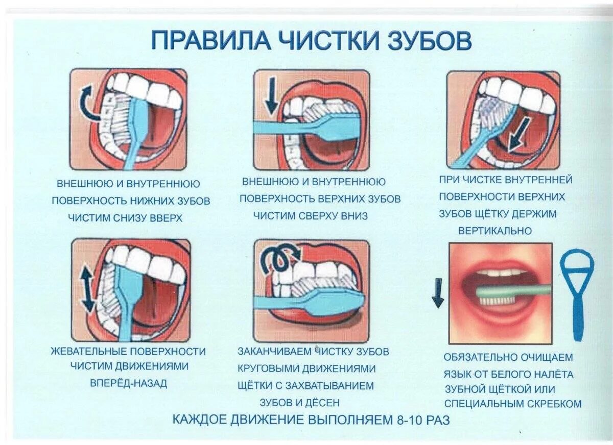 Классы полости рта. Памятка как правильно чистить зубы. Правильная методика чистки зубов зубной щёткой. Алгоритм стандартного метода чистки зубов. Схема правильной чистки зубов для детей.