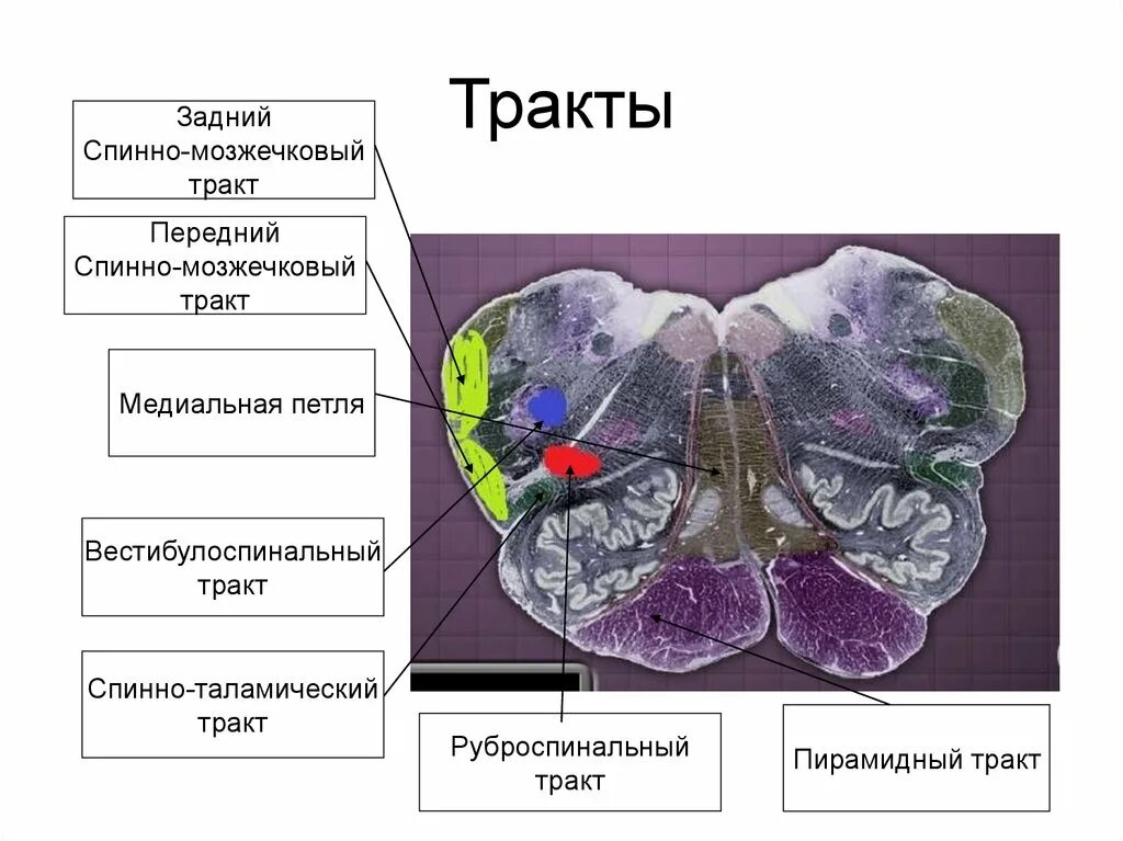 Передний спинно мозжечковый тракт. Пино мозжечковый тракт. Передний и задний спинно мозжечковые тракты. Задний спинно мозжечковый тракт.