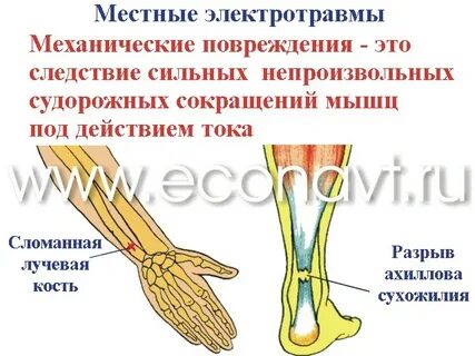 1 механическое повреждение