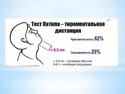 Тест расстояние