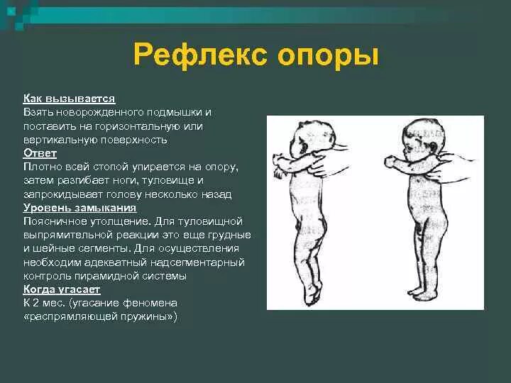 Отсутствует рефлекс опоры у новорожденного. Рефлекс опоры. Рефлексы новорожденного рефлекс опоры. Опора на стопы у новорожденных.