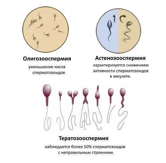 Сколько семенной жидкости