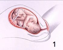 Босану кезіндегі әйелдердің кискаларының фотосуреттерін қараңыз