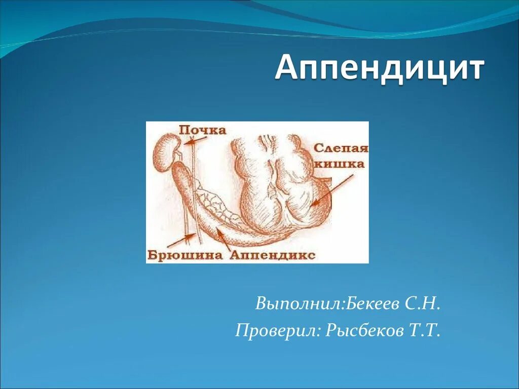 Размер аппендикса. Острый и хронический аппендицит. Хронический аппендицит презентация.