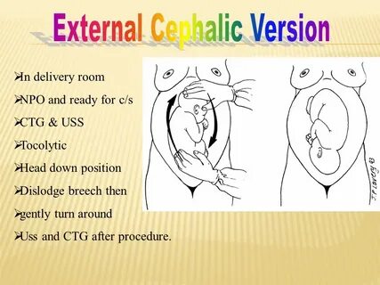 Internal version