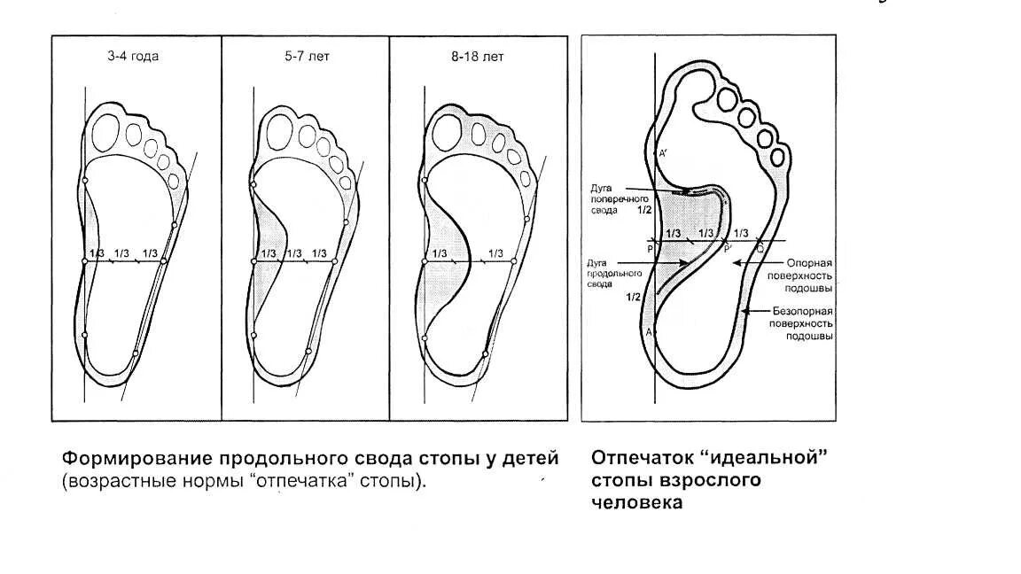 Свод точка. Период формирования свода стопы. Этапы формирования сводов стопы. Формирование свода стопы у детей. Этапы формирования стопы у ребенка.