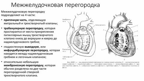 Межжелудочковая перегородка сердца это