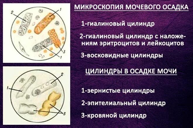 Микроскопия осадка в моче норма. Нечипоренко моча микроскопия. Микроскопия осадка мочи лейкоциты норма. Исследование мочи микроскопия осадка нормы.