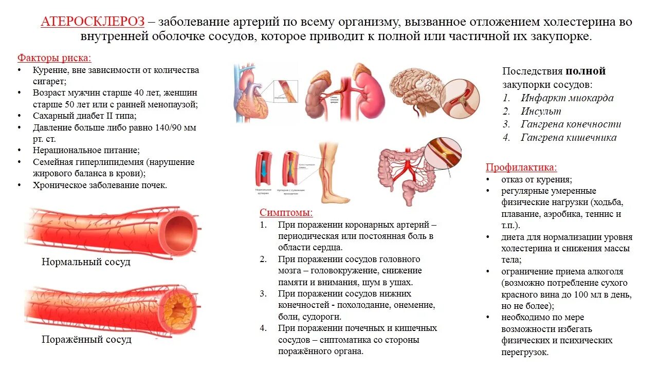 Атеросклеротические атеросклеротические поражения конечностей. Памятка атеросклероз артерий нижних конечностей профилактика. Атеросклероз сосудов памятка. Профилактика развития атеросклероза памятка. Атеросклероз нижних конечностей памятка.