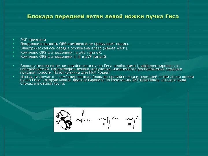 Блокада левого желудочка на экг. Блокада передней ветви левой ножки пучка. Блокады ветвей пучка гиса на экг. Блокада передней ветви желудочка. Неполная блокада левого желудочка.