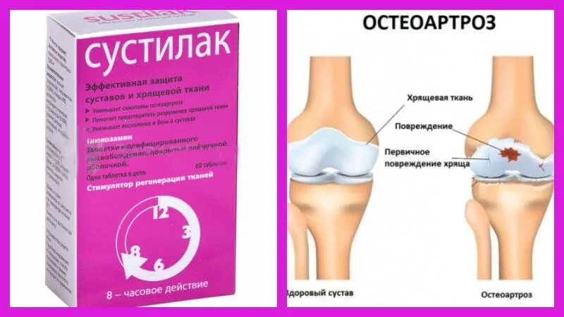 Сустилак таблетки купить