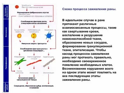 Система ран