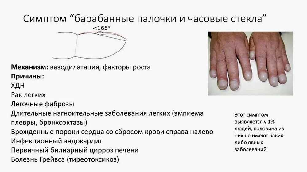 Что значит симптом