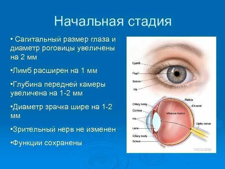 На начальных этапах хорошо. Врожденная глаукома симптомы. Глаукома начальная стадия. Изменения роговицы при врожденной глаукоме.