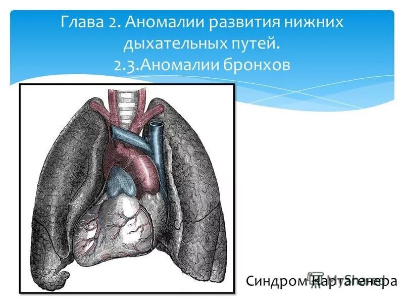 Аномалии органов дыхания. Аномалии органов дыхания