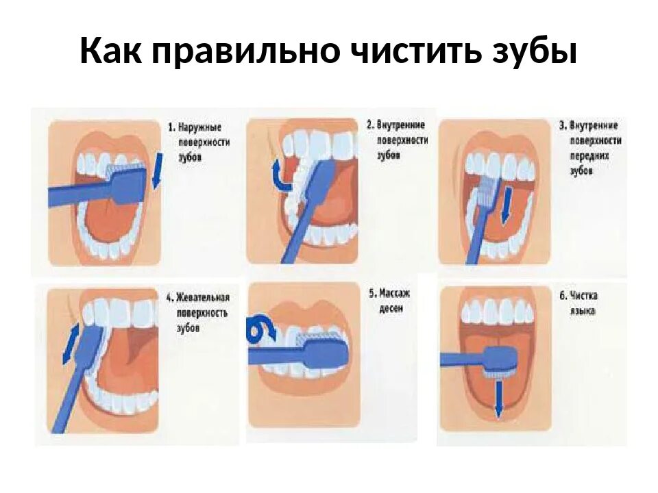 Алгоритм чистки зубов для дошкольников. Схема чистки зубов. Схема правильной чистки зубов. Правила чистки зубов для детей. Чистить значение