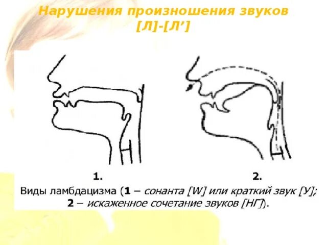 Произношение звука c. Виды ламбдацизма. Произношение звуков. Нарушение произношения звуков. Произношение звука т.