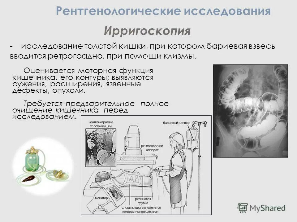 Процедура ирригоскопия кишечника. Подготовка пациента при ирригоскопии. Рентген исследование толстой кишки. Подготовка к исследованию Толстого кишечника ирригоскопия. Подготовка пациента к ригографии.