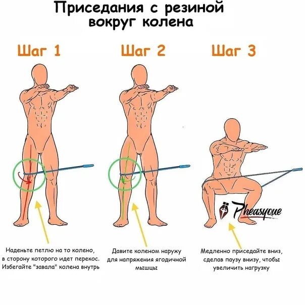 Как выровнять таз. Перекос таза как исправить. перекос таза во время приседаний. перекос таза упражнения. перекос таза упражнения для исправления.