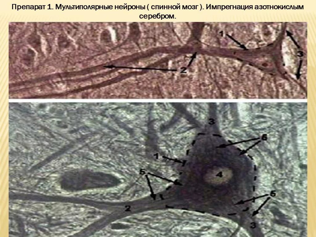 Мультиполярный Нейрон импрегнация серебром. Импрегнация серебром гистология нервная ткань. Нейрофибриллы гистология. Срез спинного мозга импрегнация азотнокислым серебром.