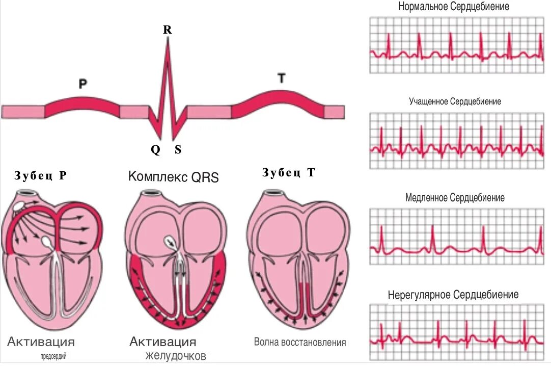 Норма форма сердца. Тип ЭКГ ритм синусовая брадикардия сердца. Нормы ЭКГ ритм сердца тахикардия. Виды сердечного ритма в норме и патологии. Сердечные ритмы какие бывают.