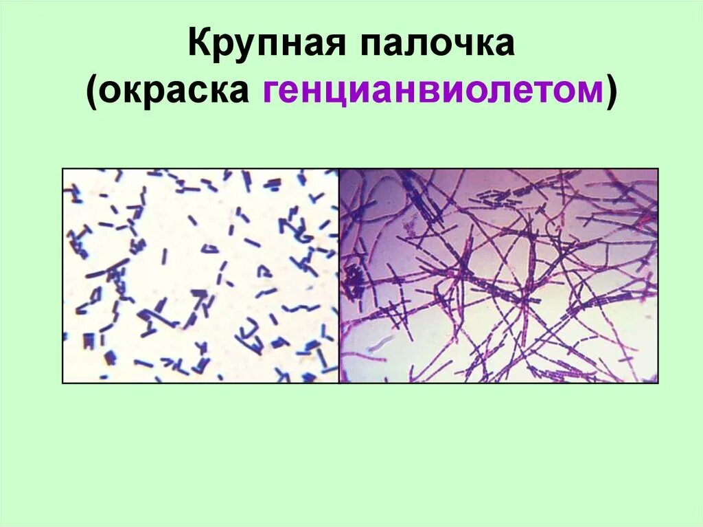 Смешанная мелкая палочка. Палочка джинни уизли. Смешанная мелкая палочка. Смешанная мелкая палочка. Возбудитель коклюша окраска по граму.