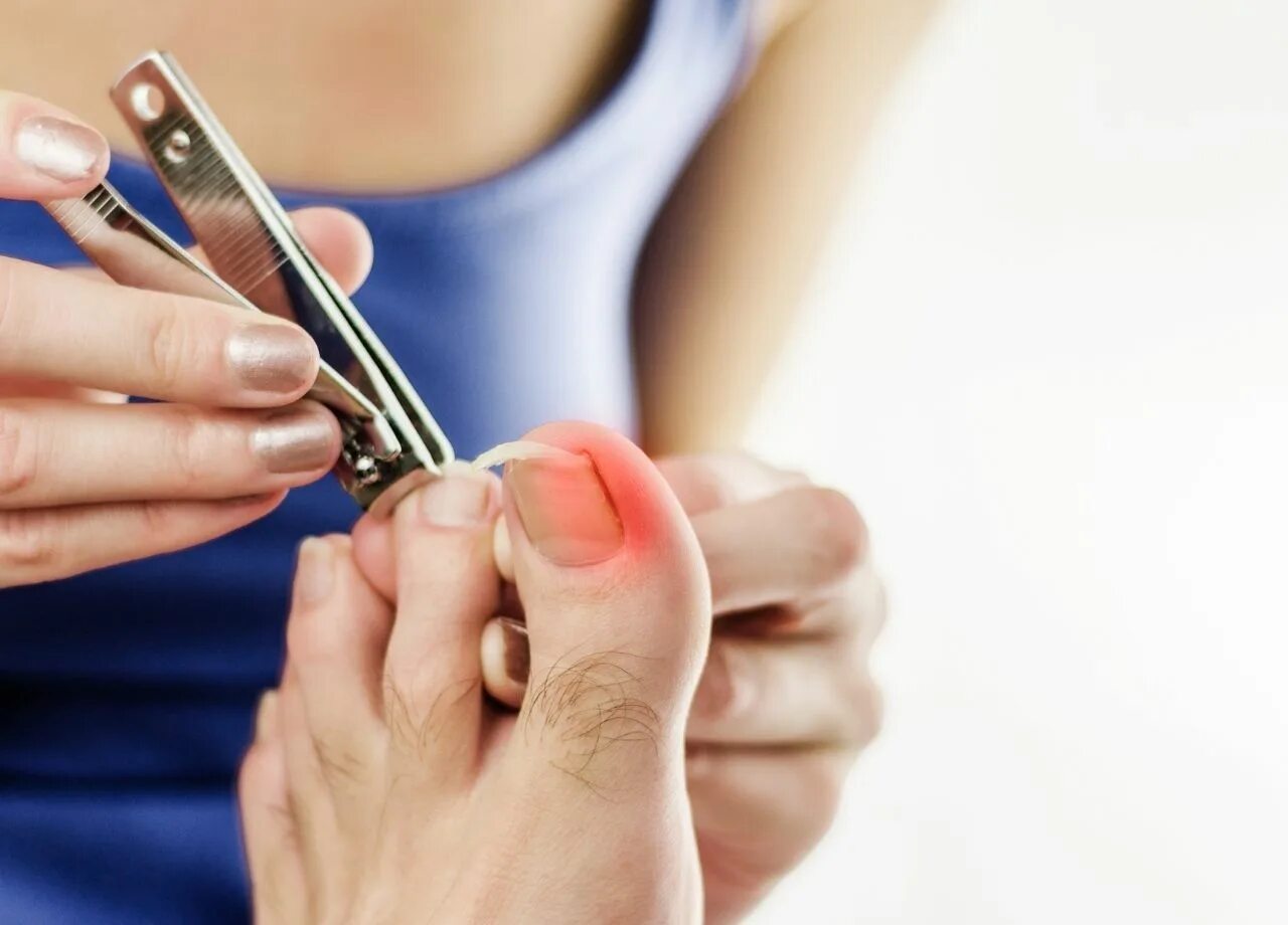 стричь ногти. стрижка ногтей новорожденному. стричь ногти в январе 2024. стричь ногти в январе 2024. неправильная стрижка ногтей.