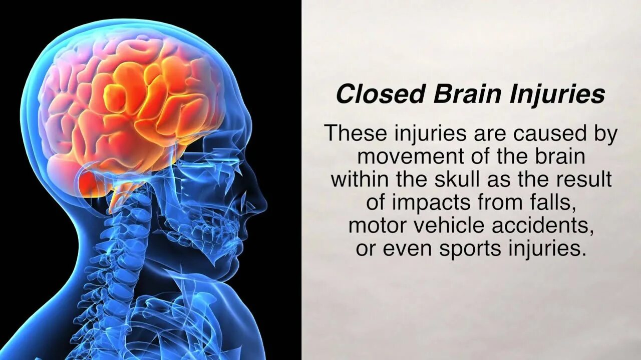 Brain injury
