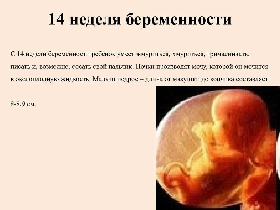 14 неделя 3 дня