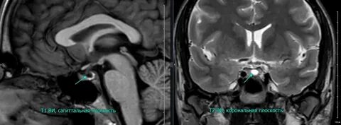 Қартайған кисканың фотосы