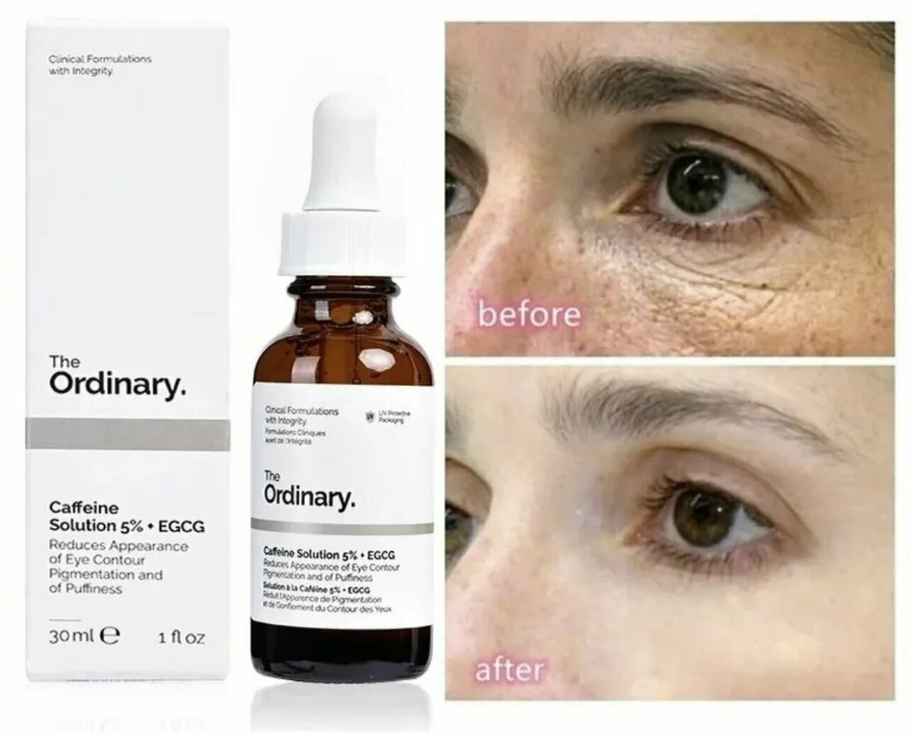 Сыворотка the ordinary Caffeine solution 5% + EGCG. Сыворотка Ординари с кофеином. Сыворотка с кофеином от тёмных кругов the ordinary Caffeine solution 5% + EGCG. The ordinary Caffeine solution 5 EGCG сыворотка для лица с кофеином.