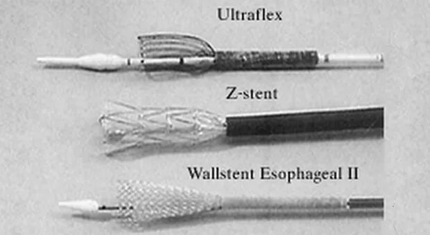 Система доставки стенты. Стент с системой доставки. Бостон Сайентифик пищеводный стент. Система доставки пластикового стента. Устройство доставки стентов.