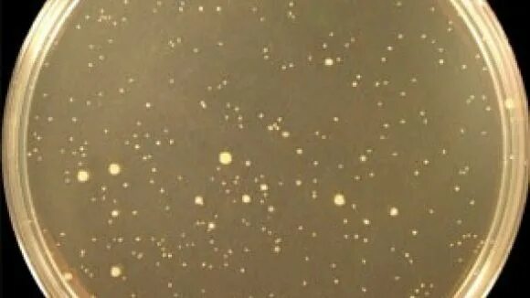 Count total bacteria. Plate count agar дрожжи. Метод count. Microfast aerobic count plate. Pca агар.