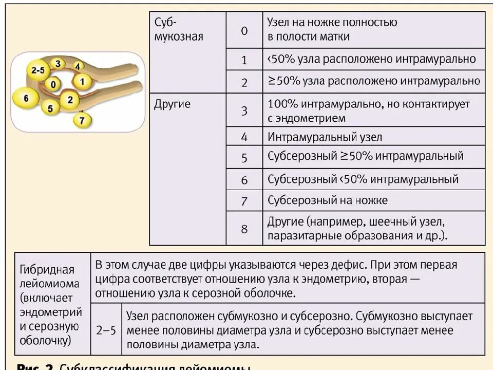 Миома фиго 4. Фиго миома классификация. Миома матки figo 4 что это значит. Миома матки figo 4 что это значит. Фиго миома классификация.