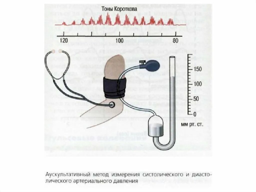 Давление биология 8 класс. Метод Короткова для измерения артериального давления. Измерение артериального давления по методу Короткова. Измерение артериального давления крови по методу Короткова. Аускультативный метод Короткова измерения артериального давления.