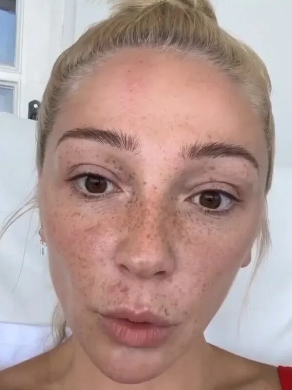 ивлеева без макияжа и фотошопа. настя ивлеева. настя ивлева без макияжа. настя ивлеева без макияжа. ивлеева анастасия веснушки.