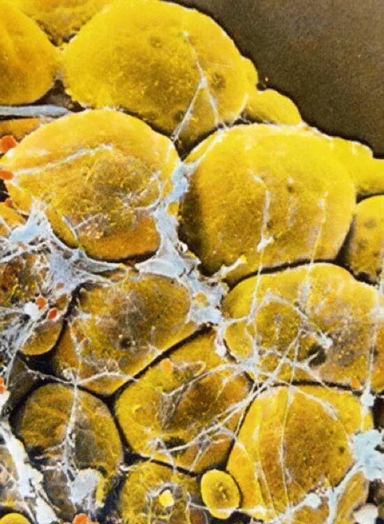 вода в жировых клетках. жировые клетки не исчезают а уменьшаются. жиры в клетке. потеря жира и потеря веса. жировые клетки под микроскопом.