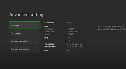 Поменять dns на xbox