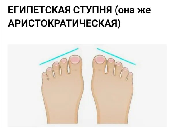Греческая форма стопы. Форма пальцев стопы. Типы стопы. Римская и Египетская стопа. 3 типа стопы