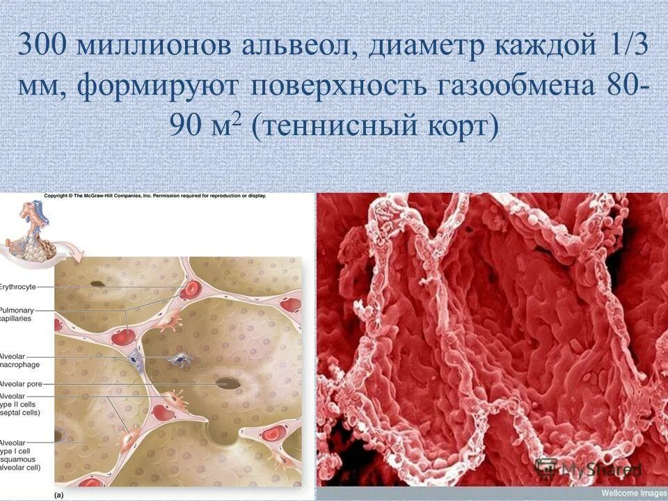 альвеолит презентация. панацинарная буллезная эмфизема это. при туберкулезе разрушаются альвеолы и капилляры легких. при туберкулезе разрушаются альвеолы и капилляры легких. капилляры альвеол легких.