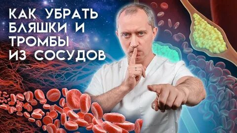 Как чистить тромбы