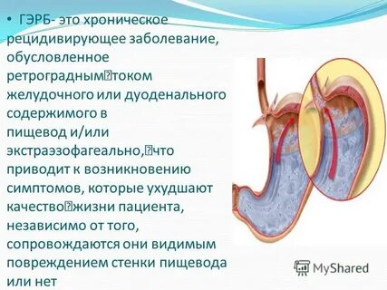 Гэрб не проходит