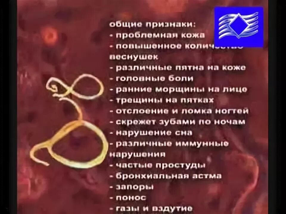 Круглый червь человеческая аскарида. Признаки наличия паразитов в организме человека. Паразиты в нашем организме. Симптомы глистов в организме человека червей. Паразиты в организме симптомы.